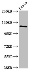 HIP1R Polyclonal Antibody
