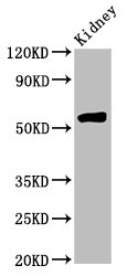 HMGCS2 Polyclonal Antibody