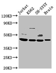 HOXD3 Polyclonal Antibody