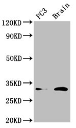 HOXD8 Polyclonal Antibody
