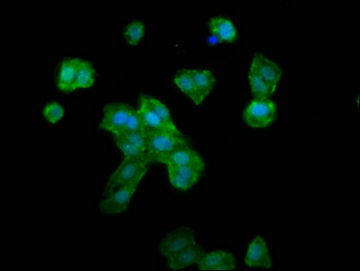 RNF39 Polyclonal Antibody