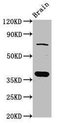 Western Blot<br />Positive WB detected in: Rat brain tissue<br />All lanes: SCAMP1 antibody at 4ug/ml<br />Secondary<br />Goat polyclonal to rabbit IgG at 1/50000 dilution<br />Predicted band size: 38, 19 KDa<br />Observed band size: 38 KDa<br />