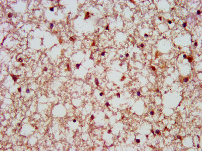 IHC image of SCAMP1 Polyclonal Antibody diluted at 1:500 and staining in paraffin-embedded human brain tissue performed on a Leica Bond&trade; system.