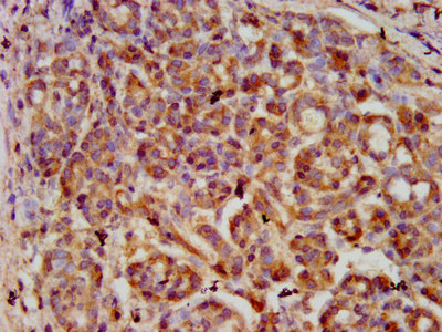 SERPINB4 Polyclonal Antibody