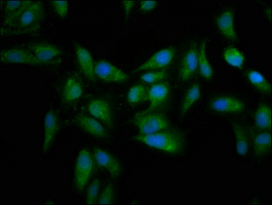 MT3 Polyclonal Antibody