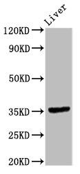 Western Blot<br />Positive WB detected in: Rat liver tissue<br />All lanes: EPCAM antibody at 9.6ug/ml<br />Secondary<br />Goat polyclonal to rabbit IgG at 1/50000 dilution<br />Predicted band size: 35 KDa<br />Observed band size: 35 KDa<br />