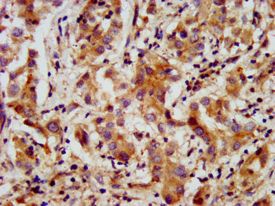 AMMECR1 Polyclonal Antibody