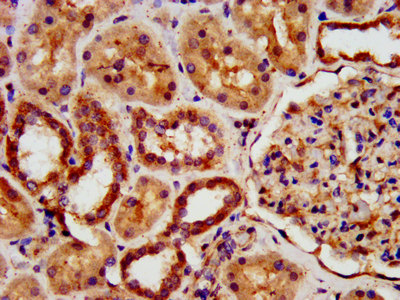 KIAA0319 Polyclonal Antibody