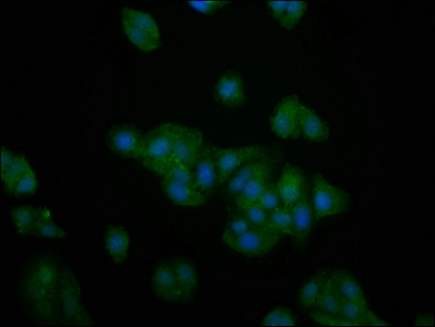 PFKFB4 Polyclonal Antibody
