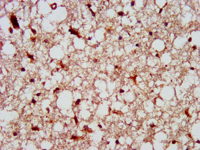 PTPN13 Polyclonal Antibody