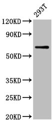 ARSH Polyclonal Antibody (100 µl)