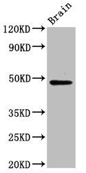 RAD9B Polyclonal Antibody (100 µl)
