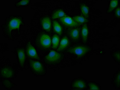 ABCA12 Polyclonal Antibody