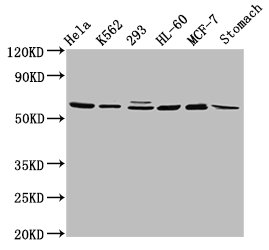 GATAD2A Polyclonal Antibody