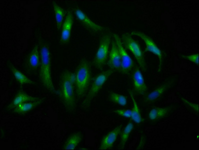 NLGN4X Polyclonal Antibody