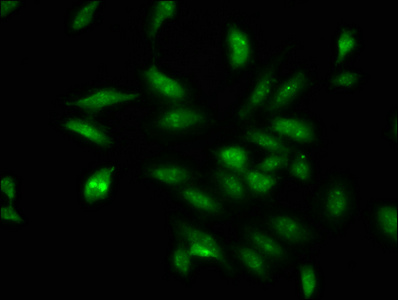 DDX17 Polyclonal Antibody (50 µl)