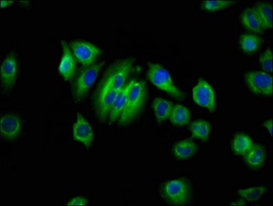 AQP10 Polyclonal Antibody