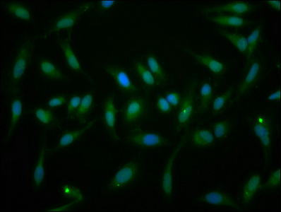 EYA1 Polyclonal Antibody