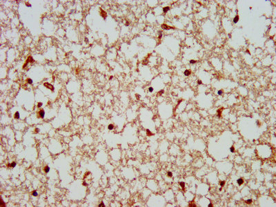 COPS8 Polyclonal Antibody (20 µl)