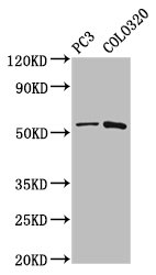 CAPS2 Polyclonal Antibody (100 µl)