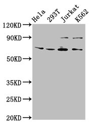 ALG9 Polyclonal Antibody