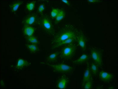 KIF15 Polyclonal Antibody