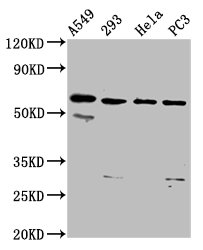 DDX28 Polyclonal Antibody (100 µl)