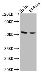 POLK Polyclonal Antibody (100 µl)