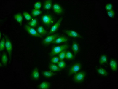 TNRC6B Polyclonal Antibody