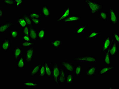 Formyl HIST1H1C (K84) Polyclonal Antibody (100 µl)