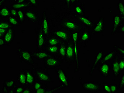 Formyl HIST1H3A (K18) Polyclonal Antibody (100 µl)