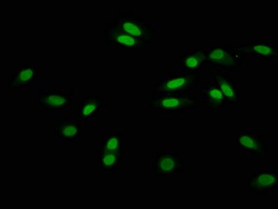 2-hydroxyisobutyryl HIST1H3A (K56) Polyclonal Antibody