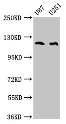 ABL2 Polyclonal Antibody