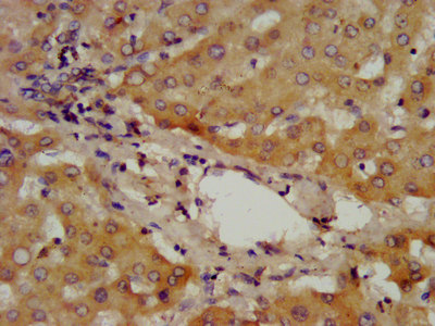 ADAMTS13 Polyclonal Antibody