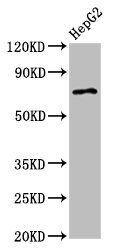 AGPS Polyclonal Antibody (100 µl)