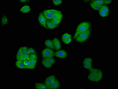 APOBEC1 Polyclonal Antibody (50 µl)