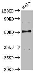 BCKDHA Polyclonal Antibody