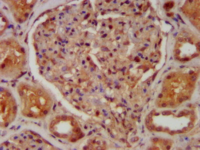 CABP4 Polyclonal Antibody (50 µl)