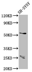 CDR2L Polyclonal Antibody