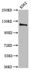 CENPJ Polyclonal Antibody