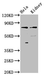 CLCNKB Polyclonal Antibody