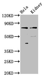 CLCNKB Polyclonal Antibody (100 µl)