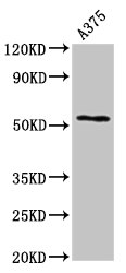 CPE Polyclonal Antibody