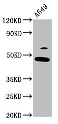 FOXL2 Polyclonal Antibody