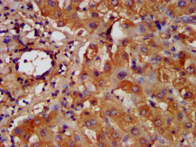 HAL Polyclonal Antibody