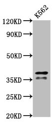 HNRNPAB Polyclonal Antibody