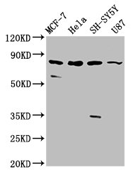 IL1RAPL1 Polyclonal Antibody