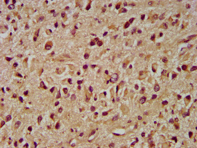 INPP5B Polyclonal Antibody