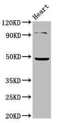 KCNJ5 Polyclonal Antibody