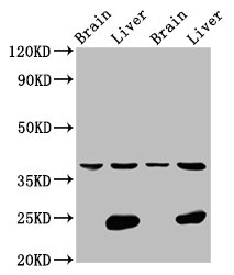 LSAMP Polyclonal Antibody